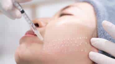 Scopri la mesoterapia per viso, corpo e capelli alla Tsioumas Clinic. Idratazione profonda e riduzione delle rughe in pochi minuti.