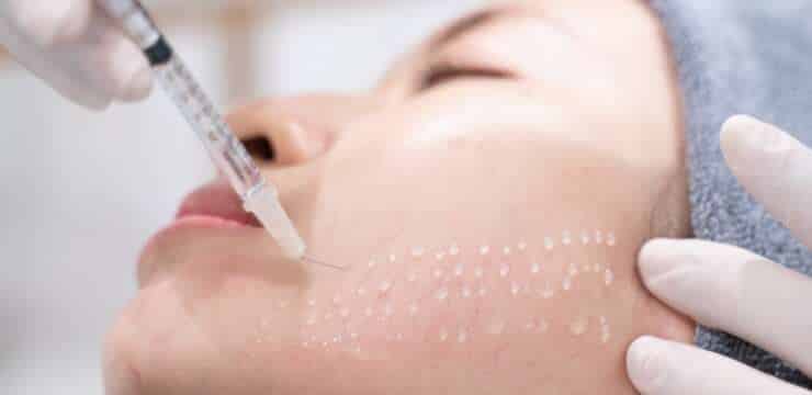 Scopri la mesoterapia per viso, corpo e capelli alla Tsioumas Clinic. Idratazione profonda e riduzione delle rughe in pochi minuti.